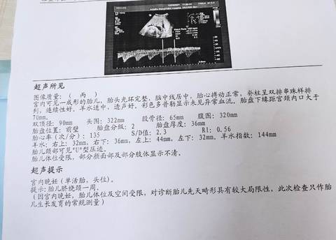 journal_insert_pic_1688336686