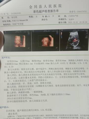 journal_insert_pic_1683880404