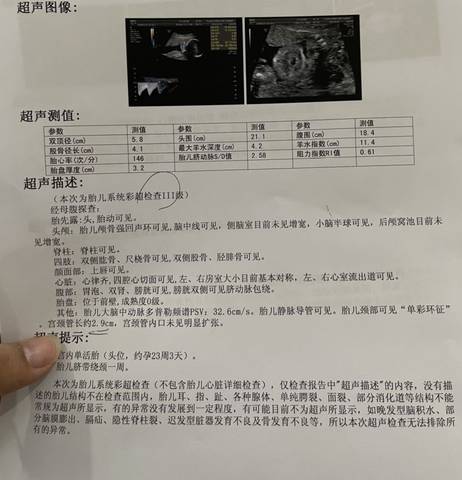 journal_insert_pic_1685283249