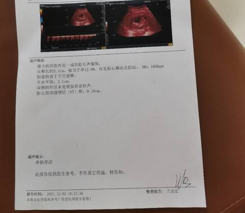 journal_insert_pic_1674598971