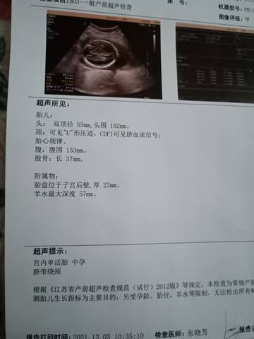 journal_insert_pic_1673050703