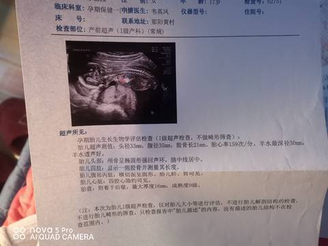 journal_insert_pic_1687862979