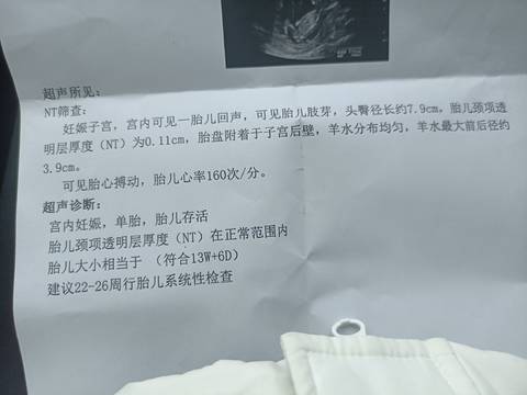 journal_insert_pic_1689292514