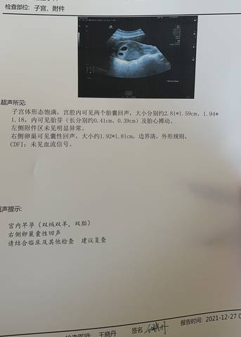 journal_insert_pic_1686993844