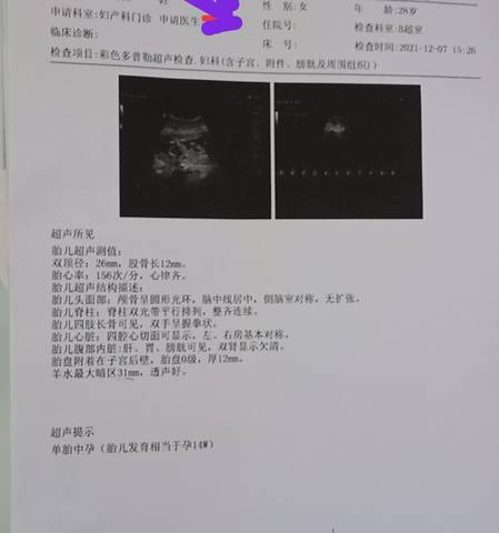 journal_insert_pic_1676091807