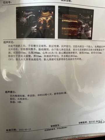 journal_insert_pic_1740895907