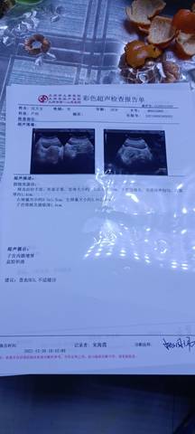 journal_insert_pic_1688470286