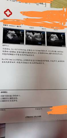 journal_insert_pic_1674700781