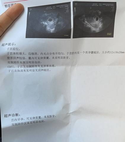 journal_insert_pic_1681029862