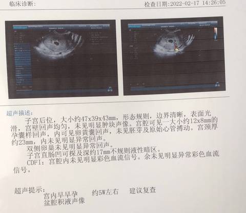 journal_insert_pic_1719493329