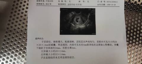 journal_insert_pic_1689581455