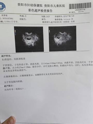 journal_insert_pic_1687602735