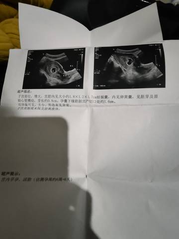 journal_insert_pic_1741122100