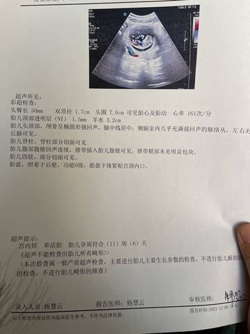 journal_insert_pic_1674836242