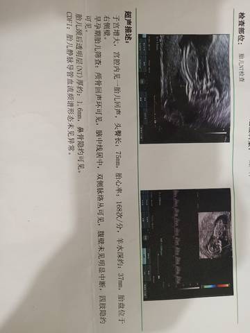 journal_insert_pic_1674316142
