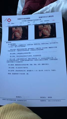 journal_insert_pic_1679368955