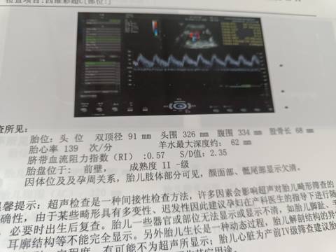 journal_insert_pic_1741034547