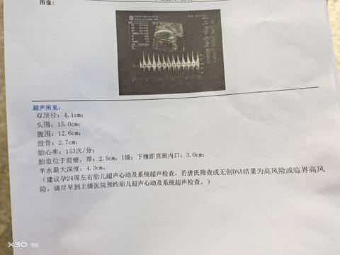 journal_insert_pic_1683555817