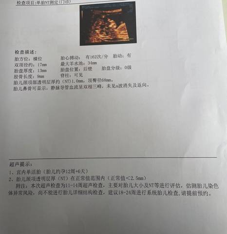 journal_insert_pic_1688710210