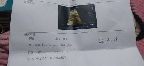 journal_insert_pic_1719935884