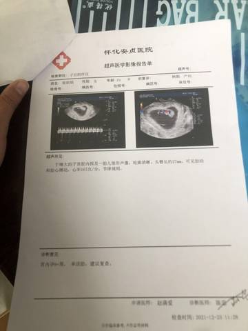 journal_insert_pic_1685362725