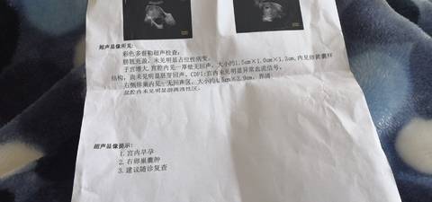 journal_insert_pic_1676801201