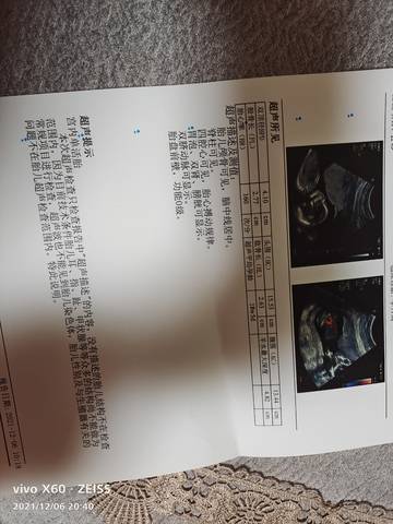 journal_insert_pic_1675060987