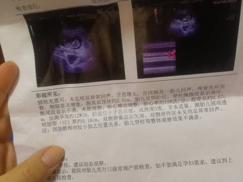 journal_insert_pic_1681045331