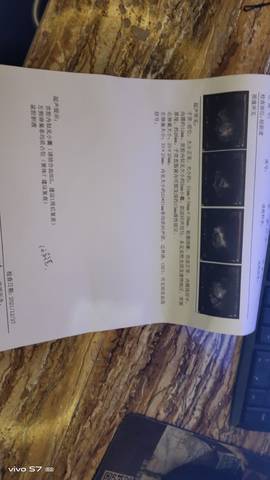 journal_insert_pic_1687412776