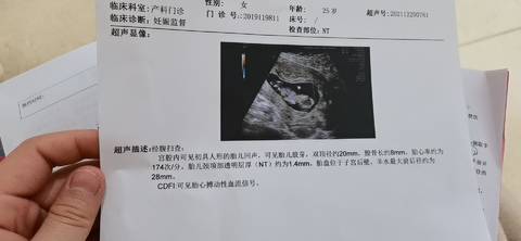 journal_insert_pic_1683184347