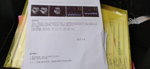 journal_insert_pic_1682560442