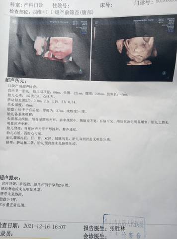 journal_insert_pic_1681220096