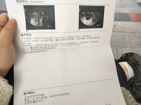 journal_insert_pic_1683543030