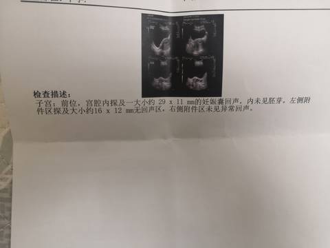journal_insert_pic_1683265500