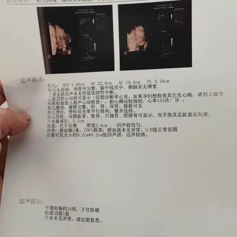 journal_insert_pic_1678515828