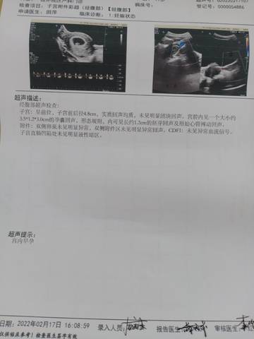 journal_insert_pic_1719427876