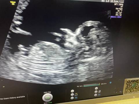 journal_insert_pic_1675836258