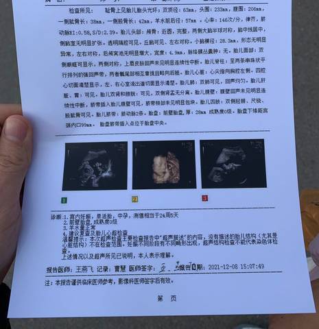 journal_insert_pic_1678754046