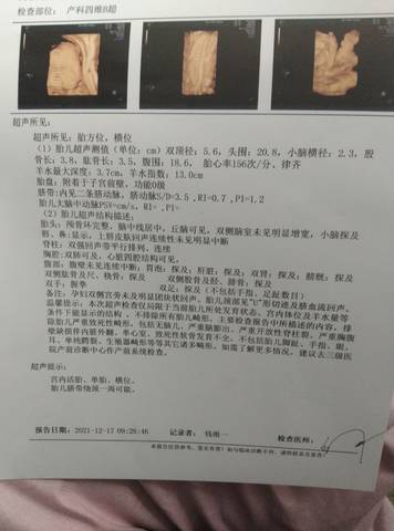 journal_insert_pic_1684035943