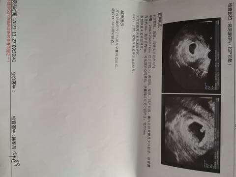 journal_insert_pic_1674886898