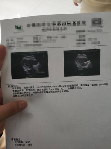 journal_insert_pic_1673403207