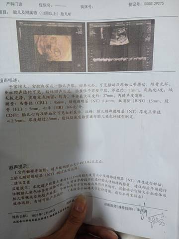 journal_insert_pic_1676608014