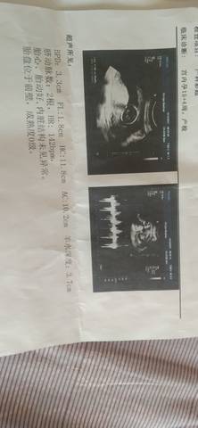 journal_insert_pic_1684580950
