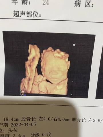 journal_insert_pic_1676859344