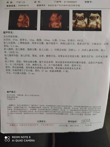 journal_insert_pic_1683086814