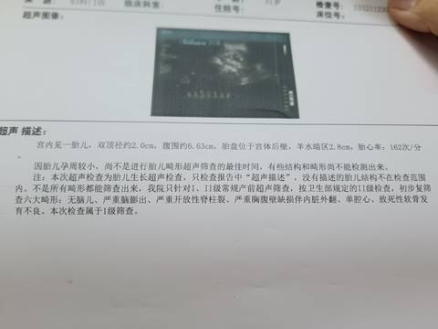 journal_insert_pic_1688806017
