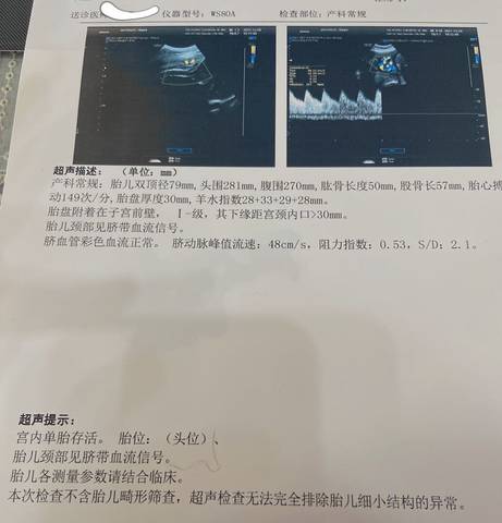 journal_insert_pic_1688339928