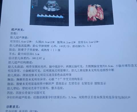 journal_insert_pic_1719791560