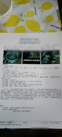 journal_insert_pic_1681831504