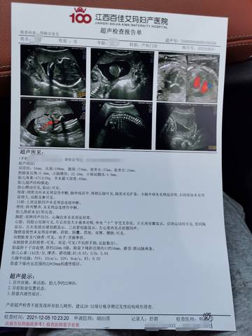 journal_insert_pic_1674754005